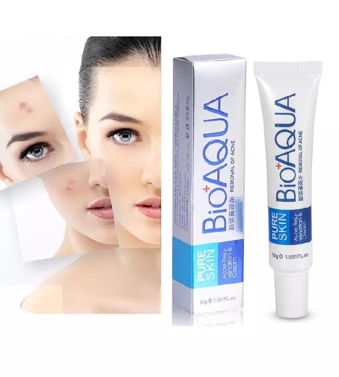 Anti Acne Scar Mark Remover Treatment Cream Price In Pakistan | Free Delivery